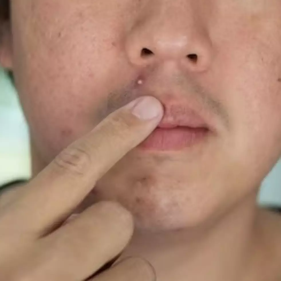 11 Rekomendasi skincare Korea untuk kulit berjerawat di bawah Rp 300 ribu, auto sehat dan glowing