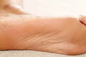 Halus tanpa tambahan madu, ini trik bikin tumit kering dan retak jadi lembut pakai 3 bahan alami