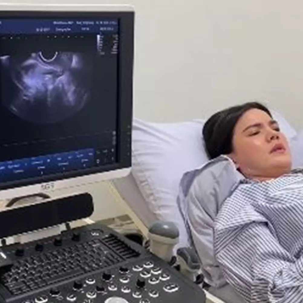 Idap kanker sarkoma hingga organ reproduksi harus diangkat, Alice Norin akui sempat syok tak percaya