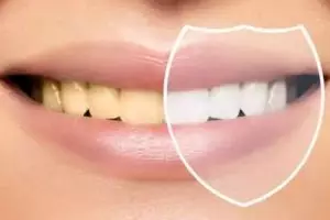 Bukan pakai garam, begini trik memutihkan gigi kuning dan berkerak pakai 1 jenis buah