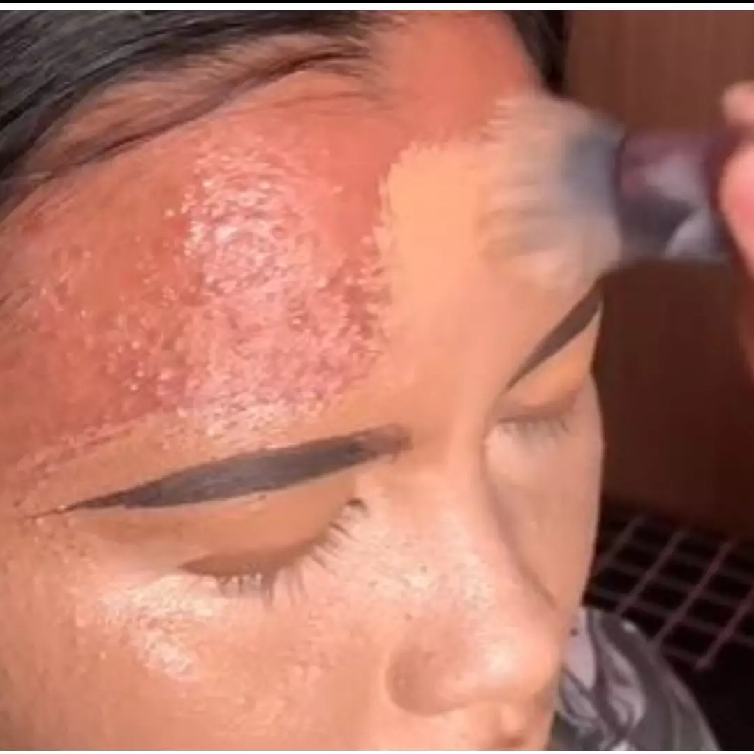 Transformasi makeup wanita wajah kemerahan karena breakout ini hasilnya auto mulus dan antidempul