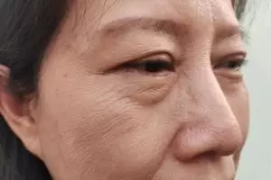 Atasi efek penuaan dini, ini trik pudarkan kerutan agar wajah tampak halus cuma pakai 1 jenis buah