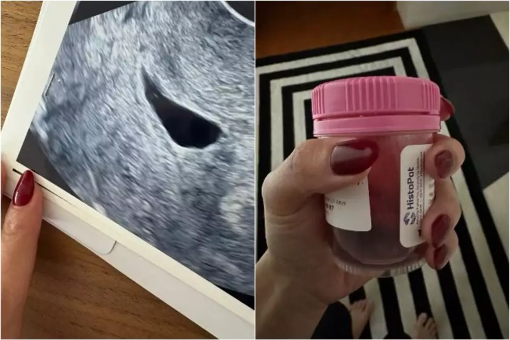 nikita willy alami keguguran © instagram