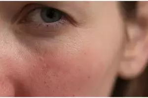 Kulit glowing bebas iritasi, ini perbedaan urutan skincare malam dan pagi kulit sensitif