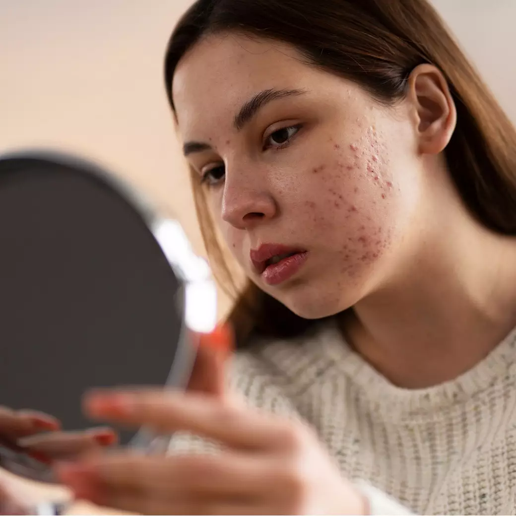 Bikin kulit glowing alami, ini trik cerahkan flek hitam versi rekomendasi dokter pakai 1 bahan pemanis