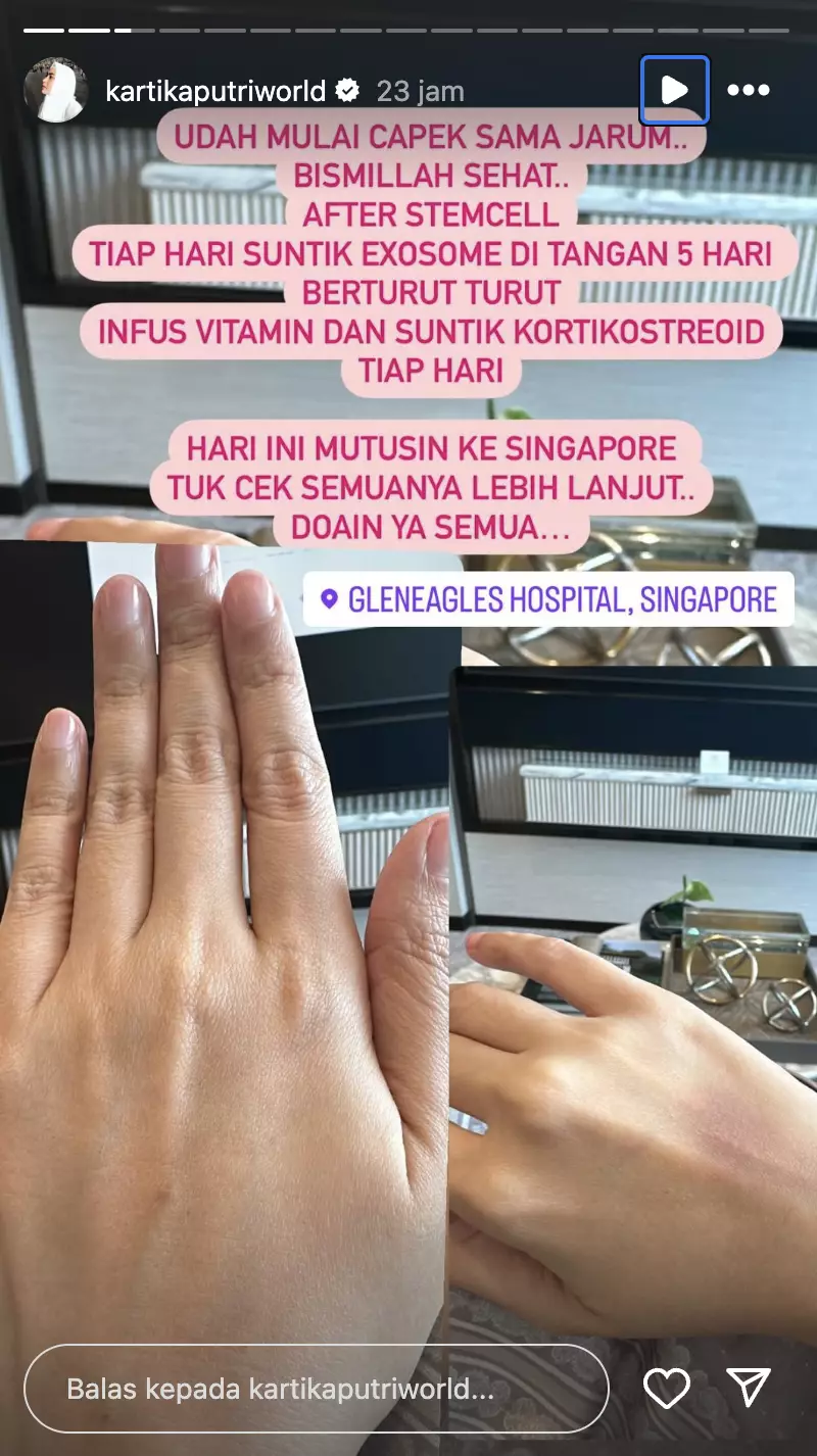 kartika putri sakit lidah dan wajah melepuh © 2024 Instagram