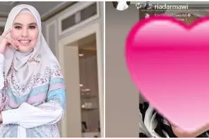 Cerita Kartika Putri alami sakit hingga bikin kulit melepuh, putuskan berobat ke luar negeri