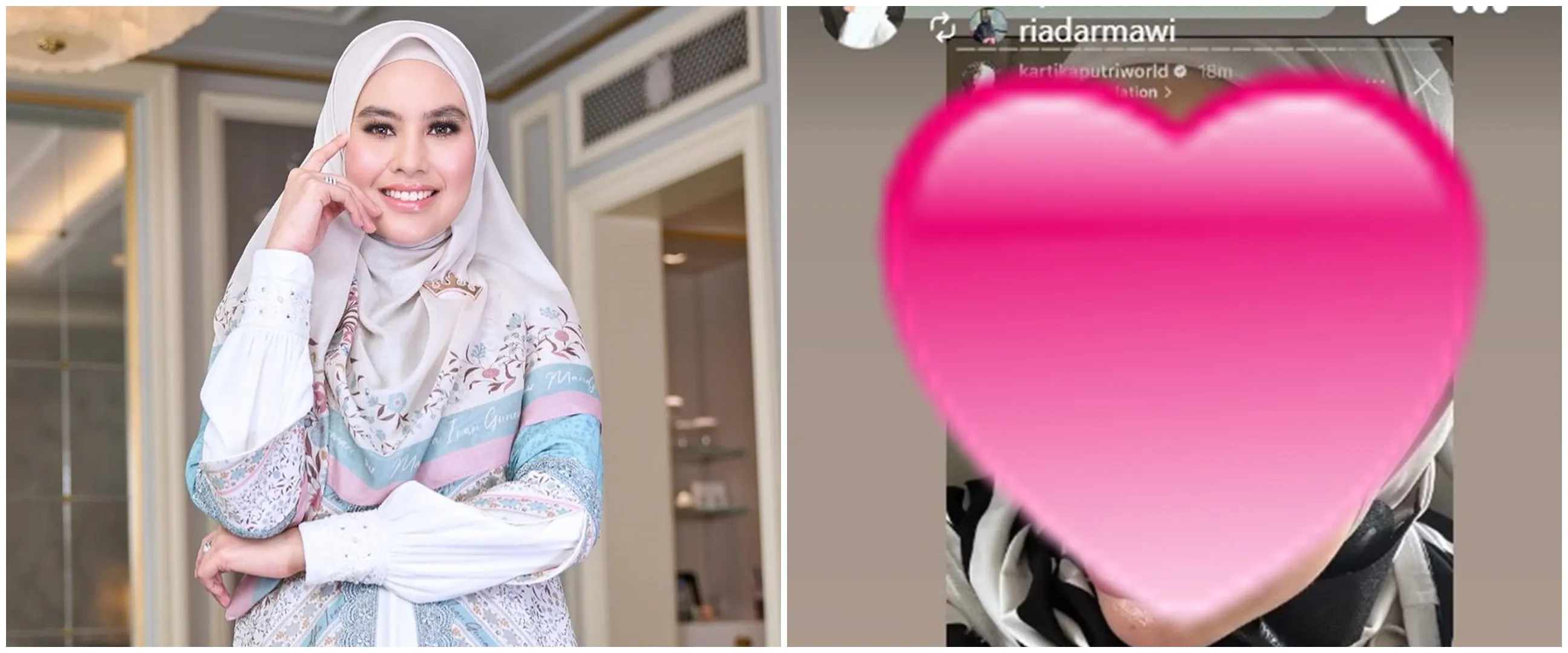 Cerita Kartika Putri alami sakit hingga bikin kulit melepuh, putuskan berobat ke luar negeri