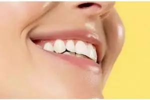 Bukan pakai garam, begini trik memutihkan gigi kuning dan berkerak pakai 1 jenis buah