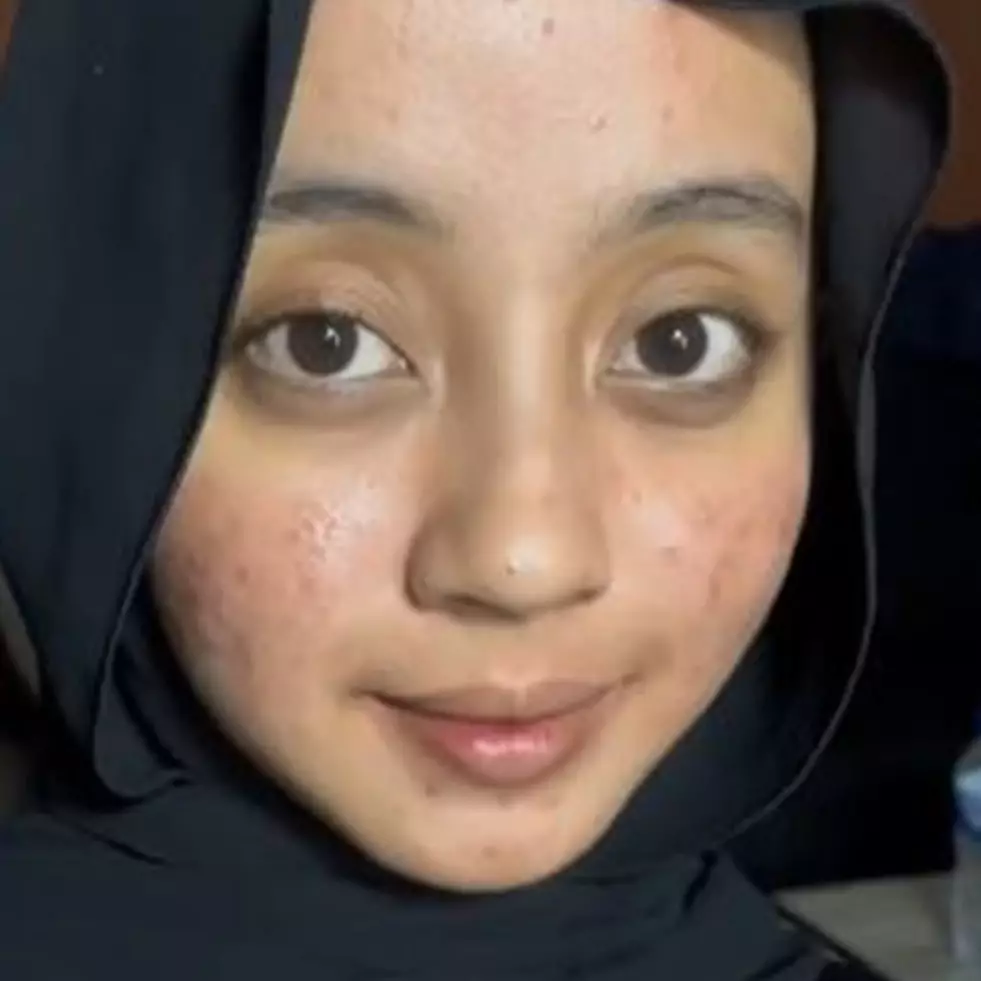 Transformasi makeup wanita dengan wajah breakout hasilnya flawless, riasan matanya bak barbie