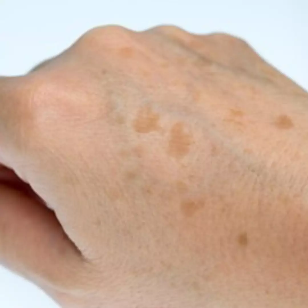 Kembali putih tanpa scrub, ini trik menghilangkan daki &amp; pigmentasi di tangan kusam pakai 1 jenis buah