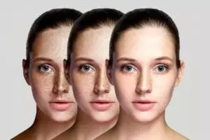 Cerah tanpa susu, ini cara bikin toner vitamin C atasi wajah penuh noda pakai 1 jenis kulit buah