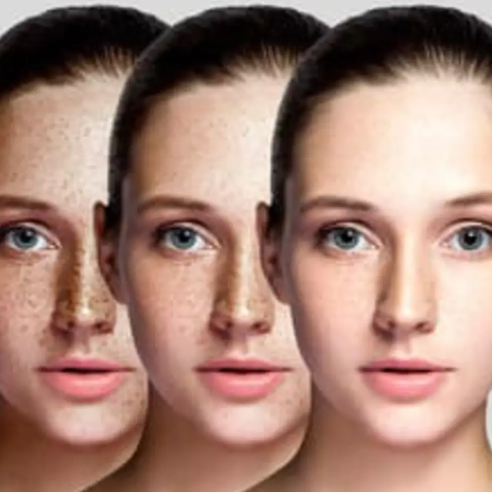 Cerah tanpa susu, ini cara bikin toner vitamin C atasi wajah penuh noda pakai 1 jenis kulit buah