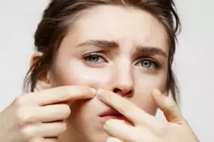 11 Produk skincare untuk menghilangkan milia merek lokal di bawah Rp 150 ribu, bikin wajah auto mulus