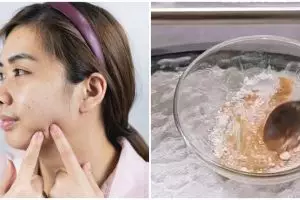 Cara menyamarkan flek hitam dan kulit kusam ini hanya pakai 1 bahan rempah, bikin wajah auto glowing