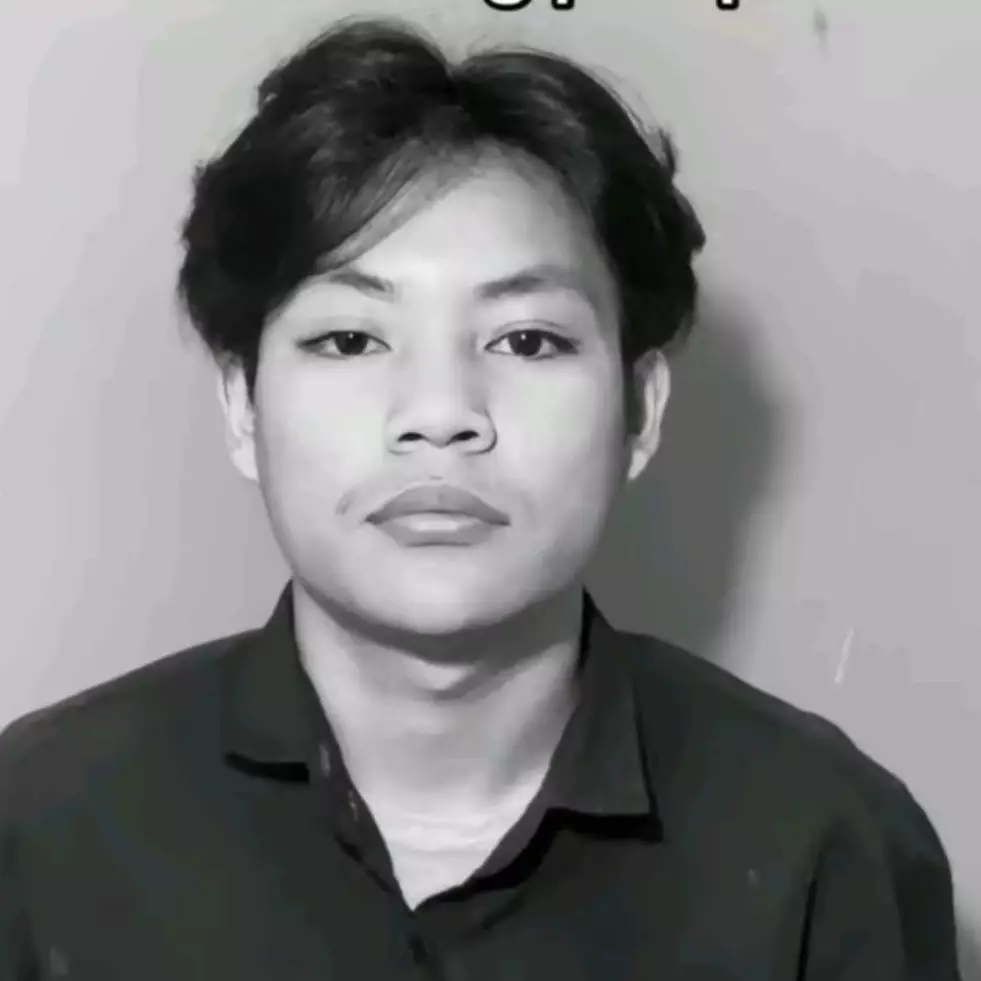 Cerita karyawan nggak diizinin tangani pelanggan karena wajah berjerawat ini nyesek banget