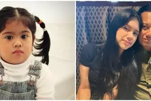 Kini jadi anak menteri, ini 11 transformasi Almira Tunggadewi dari chubby kini mirip model