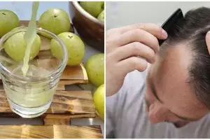 Cara menumbuhkan rambut botak pakai daun kari dicampur 1 bahan alami ala wanita ini bikin tumbuh lebat