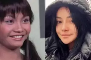 Potret dulu dan kini 15 seleb lakukan operasi hidung, penampilan Dinar Candy ini bak bumi dan langit