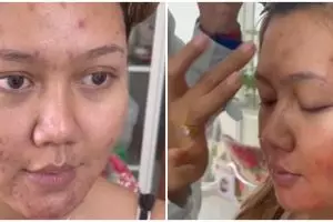Transformasi makeup wanita wajah breakout kemerahan ini hasilnya auto mulus, flawless antidempul