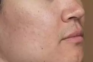 Trik mengecilkan pori-pori hanya pakai toner dari 1 bahan makanan ini bikin wajah auto mulus