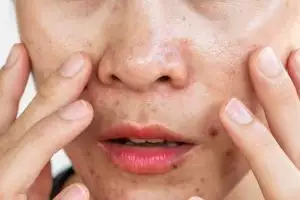 11 Rekomendasi base makeup untuk kulit berminyak harga di bawah Rp 200 ribu, auto bebas kilap