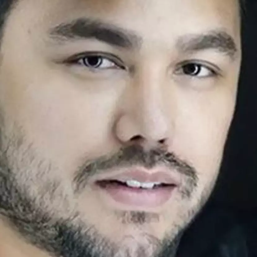 Potret 10 seleb sebelum dan sesudah filler bibir ini penampilannya makin memesona dan seksi