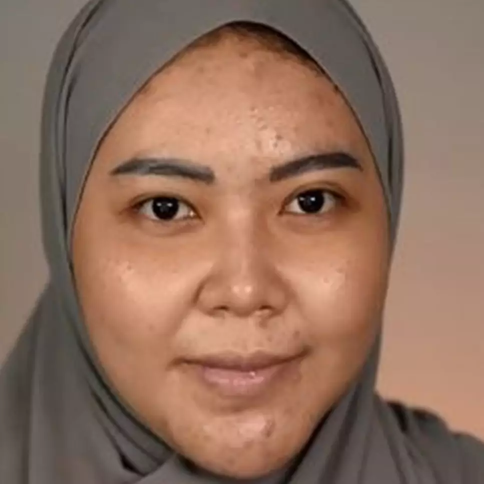 Transformasi makeup wanita dengan wajah tembeb &amp; berjerawat, hasilnya cantik paripurna bak putri raja