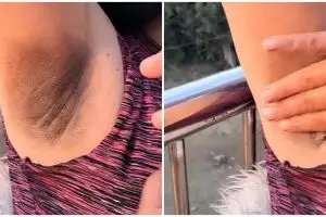 Tanpa dicampur garam, beauty vlogger ini bagikan cara mencerahkan ketiak hitam pakai 1 bahan dapur