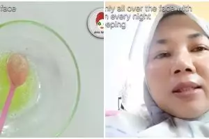 Tanpa produk skincare, emak-emak ini hilangkan flek hitam pakai minyak zaitun dicampur 1 jenis buah