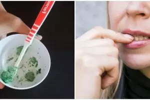 Tanpa dicampur baking soda, emak-emak ini putihkan gigi kuning pakai 1 jenis daun