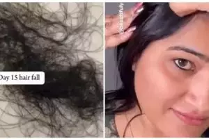 Tak perlu pakai serum, ini 11 cara menumbuhkan rambut rontok berlebih akibat stres gunakan bahan dapur