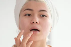 10 Cara efektif untuk mengatasi bibir yang gelap, auto tampak sehat dan merona