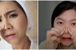 Wanita ini buktikan cara mujarab usir komedo dalam 10 menit, cuma campur baby oil dan 1 bahan alami