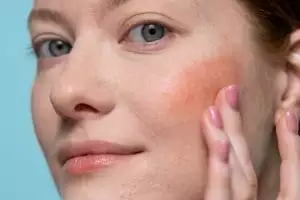 Kenali tren treatment sulam blush on, pahami risikonya untuk wajah