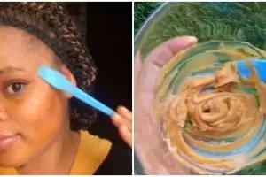 Tanpa laser, cara atasi flek hitam pakai kunyit dicampur 2 bahan alami ini bikin wajah cerah merata