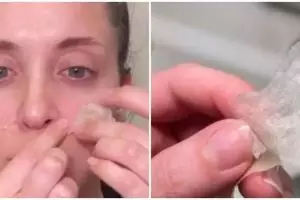 Nggak perlu beli pore pack, 13 cara menghilangkan komedo pakai bahan alami ini bikin wajah auto mulus