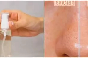 Tanpa clay mask, konten kreator ini bagikan cara atasi komedo di pipi dan hidung pakai 1 bahan dapur