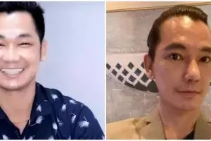 9 Potret seleb pria sebelum dan sesudah operasi plastik, penampilan Eddy Siswanto bak beda orang