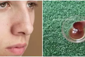 Bukan pakai oatmeal, ini trik pudarkan pori-pori besar cuma gunakan 2 bahan alami