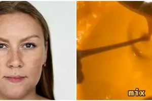 Tak cuma pakai kunyit, ini cara pudarkan flek hitam di pipi dengan tambahan 2 bahan dapur