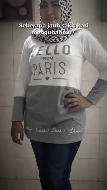 Mira Hayati sebelum perawatan © TikTok Mira Hayati sebelum perawatan © TikTok