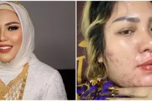 Jadi bos skincare penampilannya glowing, ini 9 potret Mira Hayati sebelum jalani perawatan kecantikan