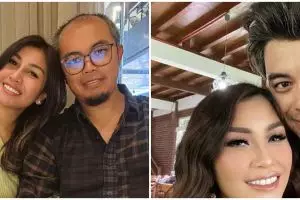 11 Potret seleb sebelum dan sesudah transplantasi rambut ini penampilannya jadi tampak lebih muda