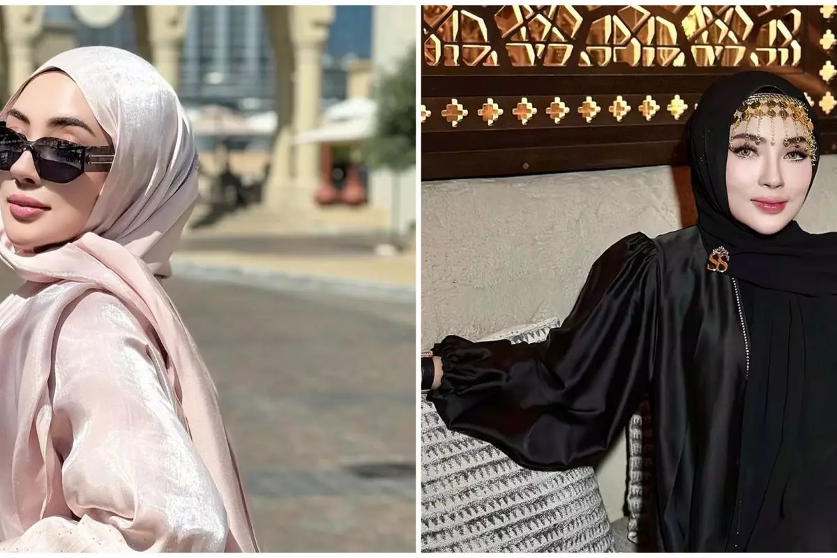 11 Transformasi bos skincare Shella Saukia yang kini makin glowing, bentuk bibir jadi sorotan