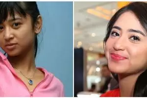 Potret sebelum dan sesudah 9 seleb lakukan sulam bibir, penampilan Dewi Perssik makin memesona