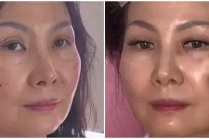 Transformasi makeup ibu-ibu wajah penuh flek hitam dirias jadi bak model, highlighternya bikin salfok