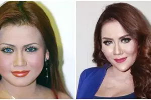 Potret 9 seleb sebelum dan sesudah face lifting, penampilan Eddy Siswanto terlihat 10 tahun lebih muda