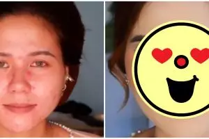 Hasilnya flawless auto mulus, transformasi makeup wanita wajah berjerawat ini beda banget sama aslinya
