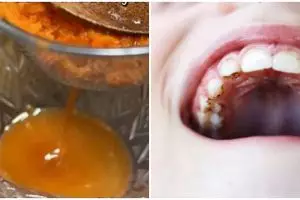 Tanpa baking soda, beauty vlogger ini bagikan cara menghilangkan gigi kuning pakai 1 jenis sayuran